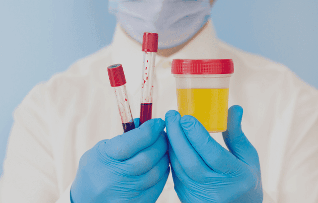 How to Test for Mercury Exposure